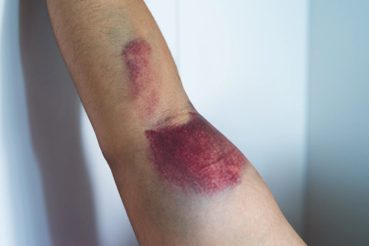 Avocat spécialisé dans le dommage corporel : un expert à vos côtés pour défendre vos droits